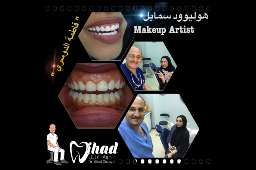 International Makeup Artist / Fatima Al Dosari
